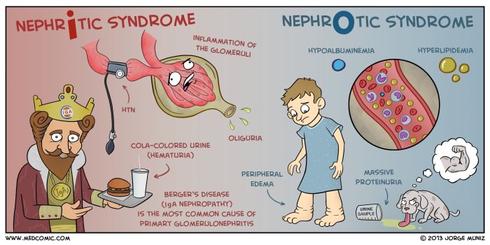 Nursing diagnosis of nephrotic syndrome