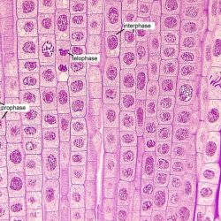 Mitosis onion stages division allium mitotic wisc