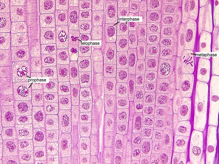 Mitosis onion stages division allium mitotic wisc